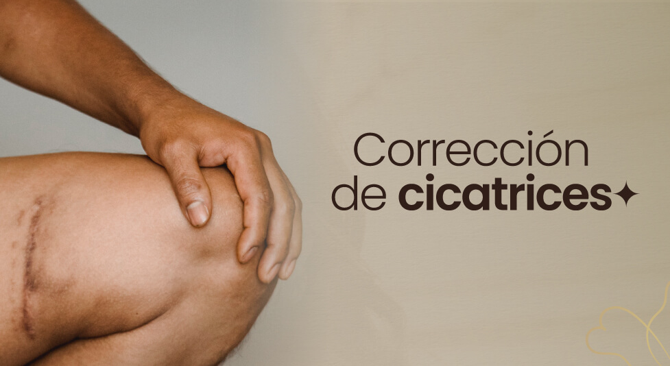 Procedimiento De Correcci N De Cicatrices Sitename